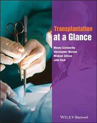 Transplantation at a Glance Paperback Wiley-Blackwell