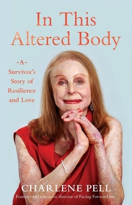 In This Altered Body: A Survivor's Story of Resilience and Love Paperback Facing Forward Books