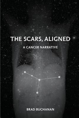 Paperback of "The Scars, Aligned" poetry collection by Finishing Line Press, showing the book cover with title and author name.