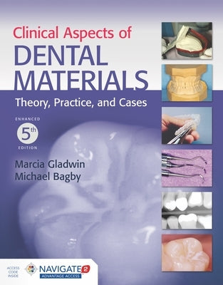 Clinical Aspects of Dental Materials Paperback Jones & Bartlett Publishers