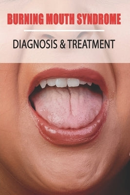 Burning Mouth Syndrome: Diagnosis & Treatment: Burning Mouth Syndrome Guide Paperback Independently Published