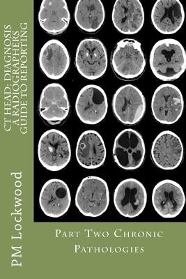 CT Head: DIAGNOSIS A Radiographers Guide To Reporting Part 2 Chronic Pathologies: Part 2 Chronic Pathologies Paperback Createspace Independent Publishing Platform