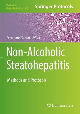 Non-Alcoholic Steatohepatitis: Methods and Protocols Paperback Humana