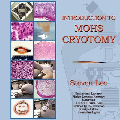 Introduction to MOHS Cryotomy Paperback 1st World Library