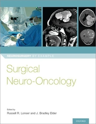 Surgical Neuro-Oncology Paperback Oxford University Press, USA
