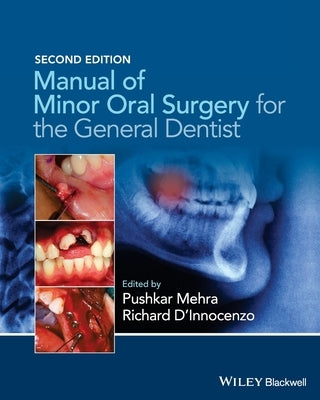 Manual of Minor Oral Surgery for the General Dentist Paperback Wiley-Blackwell