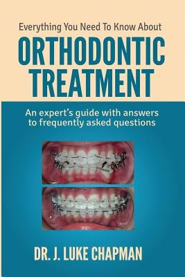 Everything You Need To Know About Orthodontic Treatment: An expert's guide with answers to frequently asked questions Paperback Createspace Independent Publishing Platform
