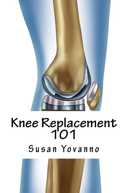 Knee Replacement 101: A User's Guide to Preparation for and Recovery After Knee Arthroplasty Paperback Physiosolutions Press