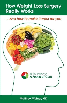 How Weight Loss Surgery Really Works: And How to Make it Work for You Paperback Independently Published