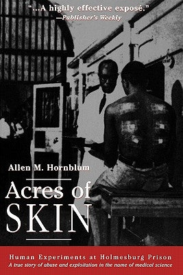 Acres of Skin: Human Experiments at Holmesburg Prison Paperback Routledge