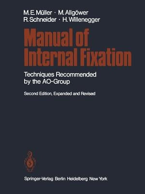 Manual of Internal Fixation: Techniques Recommended by the Ao Group Paperback Springer