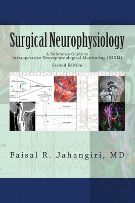 Surgical Neurophysiology - 2nd Edition: A Reference Guide to Intraoperative Neurophysiological Monitoring Paperback Createspace Independent Publishing Platform