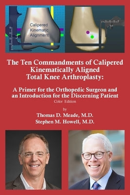 The Ten Commandments of Calipered Kinematically Aligned Total Knee Arthroplasty Paperback Author Cabin