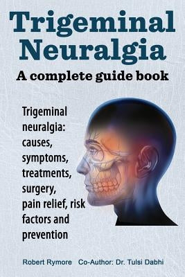 Trigeminal neuralgia: a complete guide book. Trigeminal neuralgia: causes, symptoms, treatments, surgery, Imb Publishing
