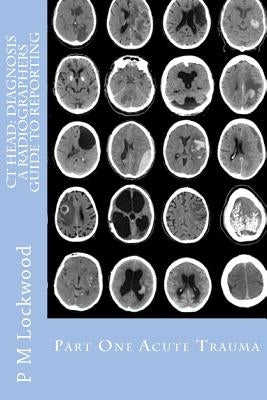 CT Head: DIAGNOSIS A Radiographers Guide To Reporting Part 1 Acute Trauma: Part One Acute Trauma Paperback Createspace Independent Publishing Platform