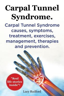 Carpal Tunnel Syndrome, Cts. Carpal Tunnel Syndrome Cts Causes, Symptoms, Treatment, Exercises, Management, Therapies and Prevention. Paperback Imb Publishing