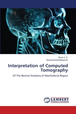 Interpretation of Computed Tomography Paperback LAP Lambert Academic Publishing