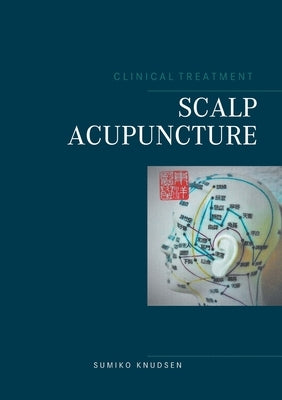 Scalp Acupuncture Paperback Books on Demand
