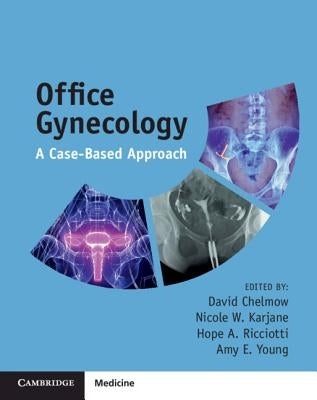 Office Gynecology: A Case-Based Approach Paperback Cambridge University Press
