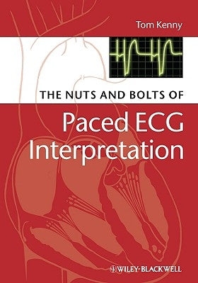 The Nuts and Bolts of Paced ECG Interpretation Paperback Wiley-Blackwell