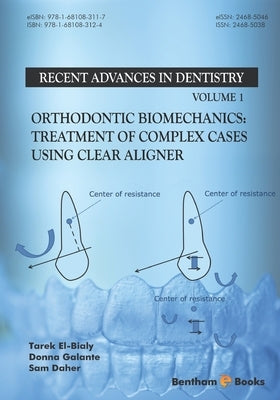 Orthodontic Biomechanics: Treatment Of Complex Cases Using Clear Aligner Paperback Bentham Science Publishers