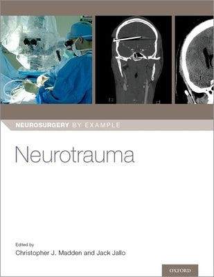 Neurotrauma Paperback Oxford University Press, USA