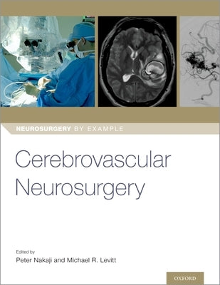 Cerebrovascular Neurosurgery Paperback Oxford University Press, USA