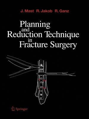 Planning and Reduction Technique in Fracture Surgery Paperback Springer