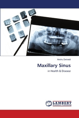 Maxillary Sinus Paperback LAP Lambert Academic Publishing