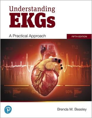 Understanding EKGs Paperback Pearson