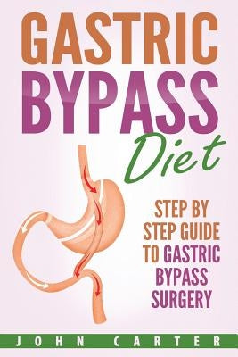 Gastric Bypass Diet: Step By Step Guide to Gastric Bypass Surgery Paperback Guy Saloniki