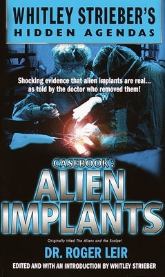 Casebook: Alien Implants by Leir, Roger