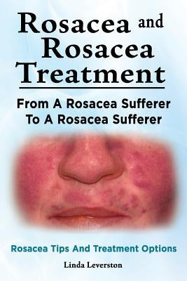 Rosacea and Rosacea Treatment. From A Rosacea Sufferer To A Rosacea Sufferer. Rosacea Tips And Treatment Options Paperback Imb Publishing Rosacea Rosacea Treatment