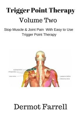 Trigger Point Therapy - Volume Two: Stop Muscle and Joint Pain naturally with Easy to Use Trigger Point Therapy Paperback Createspace Independent Publishing Platform