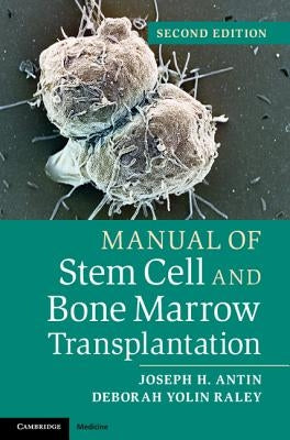 Manual of Stem Cell and Bone Marrow Transplantation Paperback Cambridge University Press
