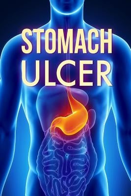 Stomach Ulcer: Treatment in 60 days!: Stomach Ulcer treatment Paperback Createspace Independent Publishing Platform