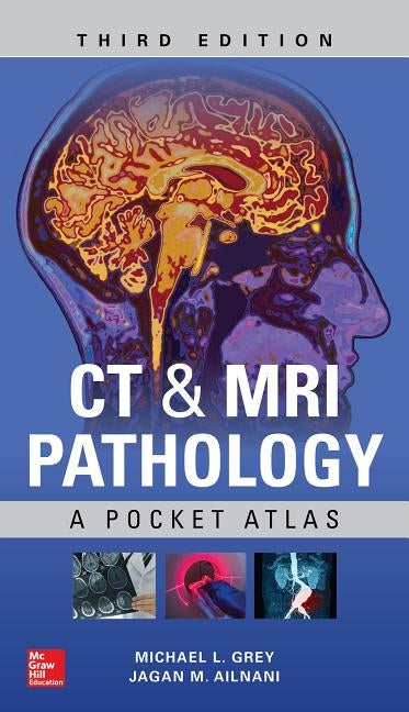 CT & MRI Pathology: A Pocket Atlas, Third Edition Paperback McGraw Hill / Medical