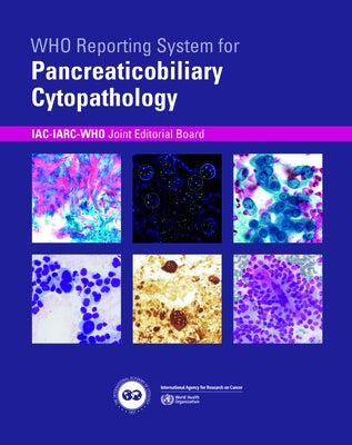 Who Reporting System for Pancreaticobiliary Cytopathology Paperback World Health Organization
