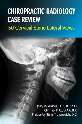 Chiropractic Radiology Case Review: 50 Cervical Spine Lateral Views Paperback Independently Published