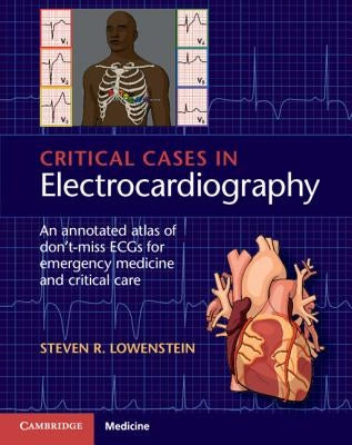 Critical Cases in Electrocardiography: An Annotated Atlas of Don't-Miss Ecgs for Emergency Medicine and Critical Care Paperback Cambridge University Press