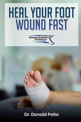Heal Your Foot Wound Fast Paperback Independently Published