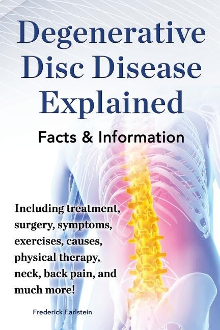 Degenerative Disc Disease Explained. Including Treatment, Surgery, Symptoms, Exercises, Causes, Physical Therapy, Neck, Back, Pain, and Much More! Fac Paperback Nrb Publishing