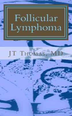 Follicular Lymphoma: Fast Focus Study GUide Paperback Createspace Independent Publishing Platform
