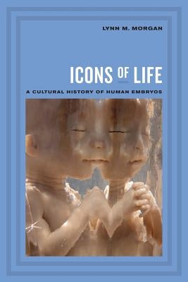 Icons of Life: A Cultural History of Human Embryos Paperback University of California Press
