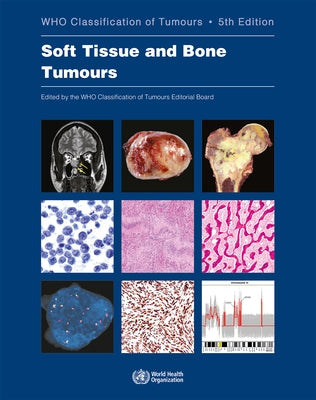 Soft Tissue and Bone Tumours: Who Classification of Tumours Paperback World Health Organization