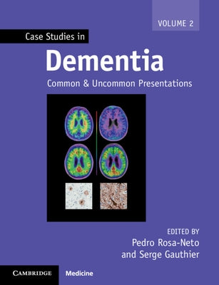 Case Studies in Dementia: Volume 2: Common and Uncommon Presentations Paperback Cambridge University Press