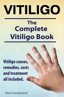 Vitiligo. Vitiligo causes, remedies, costs and treatment all included. The complete Vitiligo Book. Paperback Imb Publishing