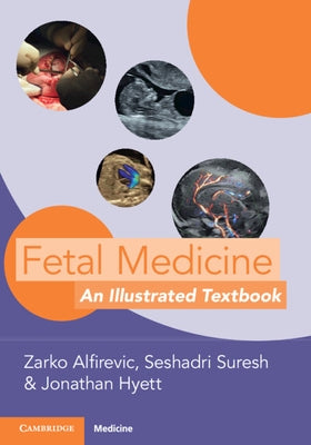 Fetal Medicine: An Illustrated Textbook Paperback Cambridge University Press