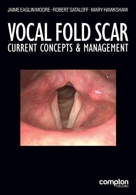 Vocal Fold Scar: Current Concepts and Management Paperback Compton Publishing Ltd