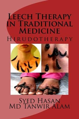 Leech Therapy in Traditional Medicine: Hirudotherapy Paperback Createspace Independent Publishing Platform